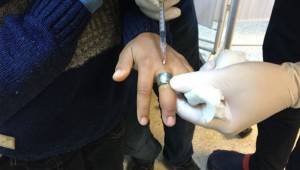 Parmağına sıkışan yüzüğü İtfaiye çıkardı