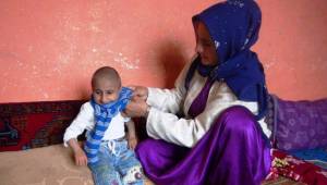 7 Yaşındaki Urfalı Çocuk gün geçtikçe biraz daha eriyor