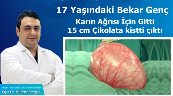 Karın Ağrısı için gitti,Karnında 15 Cm�lik Çikolata Kisti çıktı