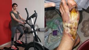 Ayakları Kesilecek Denildi Sporla Hayat Buldu