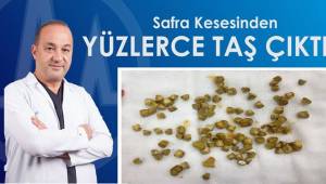 Safra Kesesinden Yüzlerce Taş Çıktı