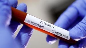 Şanlıurfa'da 139 ev karantinaya alındı 