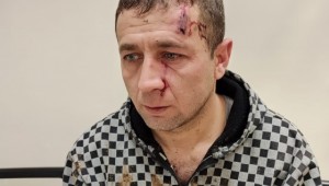 Veteriner Hekim aşı ve küpeleme yaparken yaralandı