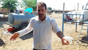 Acemi kasap elini kesti 